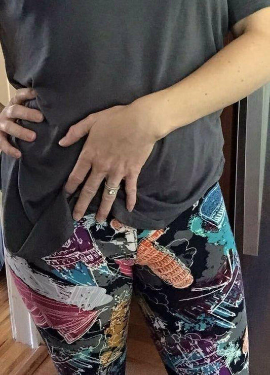 Pattern Placement Extreme Failures! - Olganna